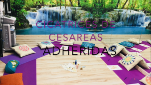 Tratamiento de cesáreas